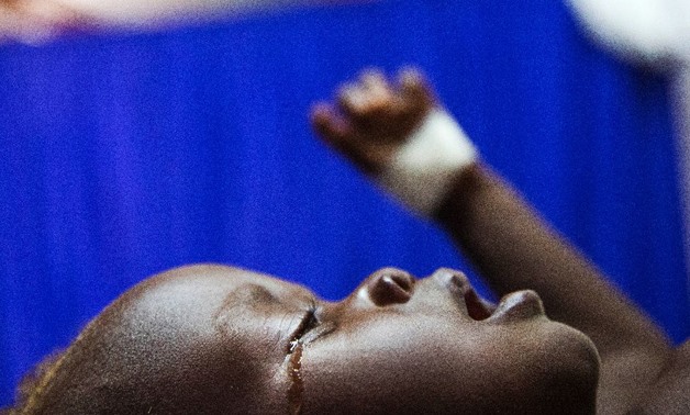 Achol Ri, a one-and-a-half year-old child with severe malnutrition, cries at a clinic run by Doctors Without Borders (MSF) in Aweil, South Sudan - AFP