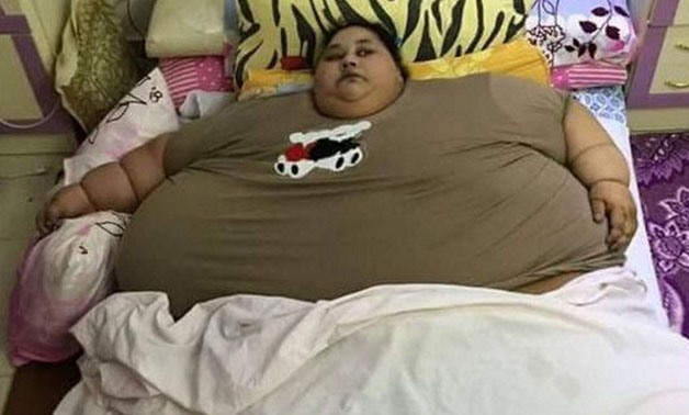 Worlds Heaviest Person Soon To Lose Her Title After Losing 120kg 